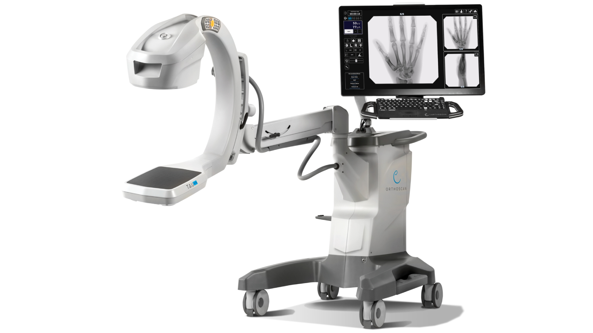 C-arm X-ray machine setup