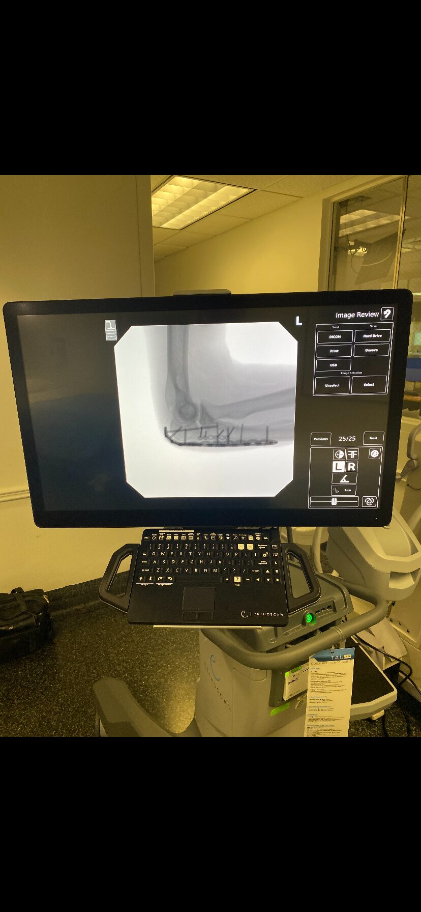 Hospital X-ray machine in use
