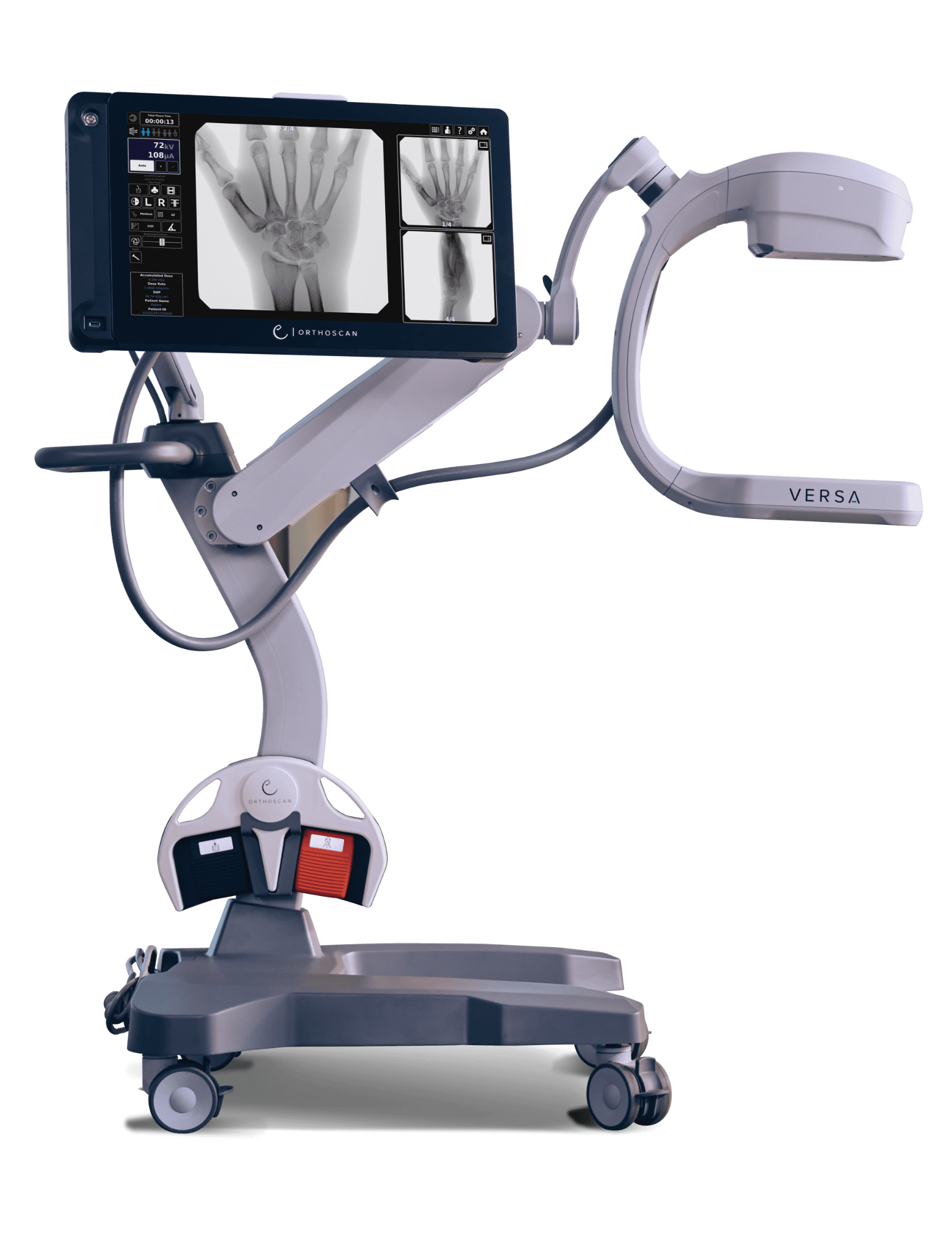 Medical imaging equipment with X-ray screen